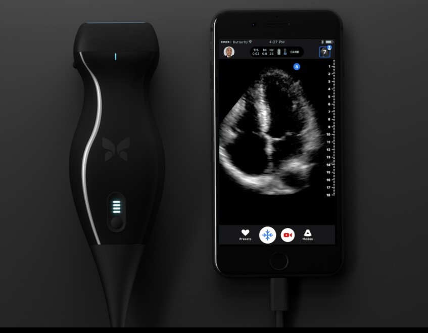 New-Device-Conduct-Ultrasound-With-Smartphone-biotech