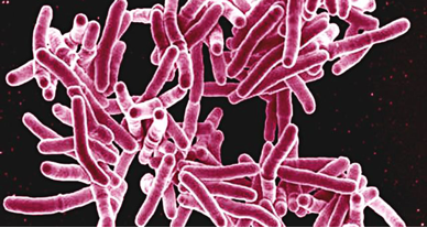 new-way-to-make-bacteria-glow-could-simplify-TB-screening