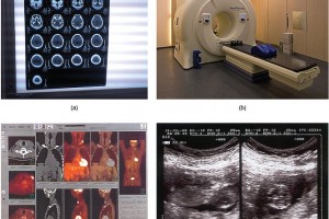 Toshiba Improves Medical Equipment Reliability