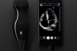 A New Device Lets You Conduct an Ultrasound With a Smartphone