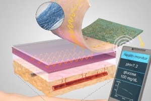 “Smart” thread that collects diagnostic data when sutured into tissue