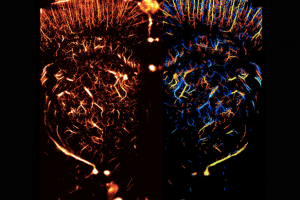 Ultrasound Microscopy: The Next Step To Imaging Blood Vessels