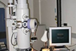 5 THINGS YOU SHOULD KNOW ABOUT ELECTRON MICROSCOPE