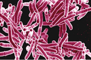 New way to make bacteria glow could simplify TB screening
