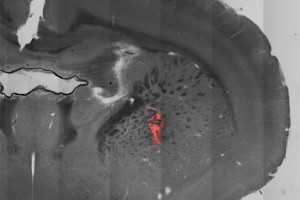 Magnetothermal Genetics: A Fourth Tool in the Brain-Hacking Toolbox