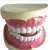 Teeth Model