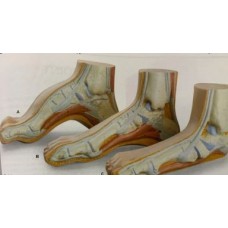 Foot Model Showing 3 Positions.