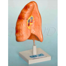 Human Lungs Model