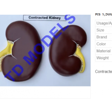 Contracted Kidney Biological Models
