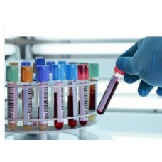 Covid-19 Rapid Test Kit