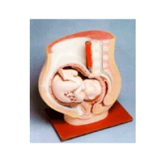 Human Pelvis With Baby