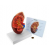 Kidney Anatomy Model