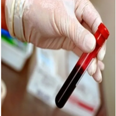 Pathological Lab Products