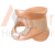 Cervical Philadelphia Collar