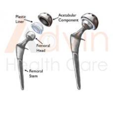 Hip Implants