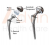 Hip Implants