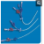 Dialysis Catheter