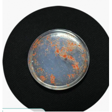 Microbial Identification