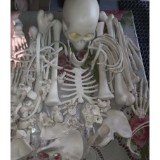 Human Skeleton Model Disarticulated