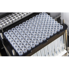 Automated Nucleic Acid Extraction