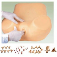 Advanced Gynecological Training Models