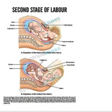Midwifery and Child Health Nursing Charts