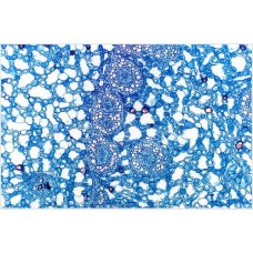 Craft's Botany Permanent Slides: Aerenchyma