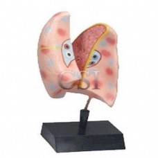 Human Lung Indian
