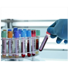 Rapid Test for Antigen-Antibody