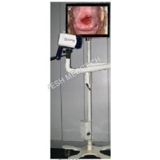 Digital Video Colposcope