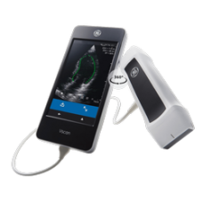 Portable Wireless Ultrasound Machine