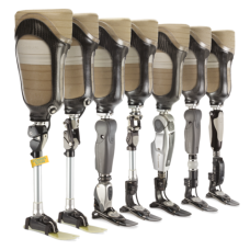 Above Knee Prosthesis
