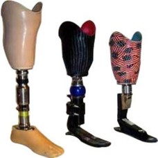 Below Knee Prosthesis