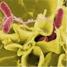 Bacterial Toxins And Anti Toxins