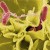 Bacterial Toxins And Anti Toxins