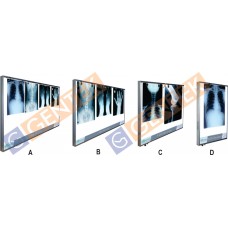 GM 9003 Led X-ray View Box