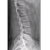X-RAY LS SPINE LAT VIEW