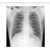 X-RAY CHEST PA VIEW