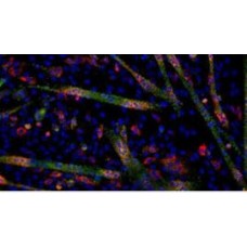 Micro RNA Research