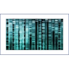 Electrophoresis