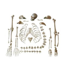 Disarticulated Skeleton