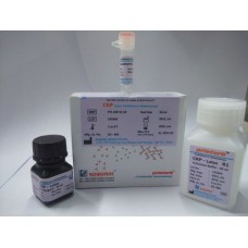 Prieturb CRP Latex Reagents