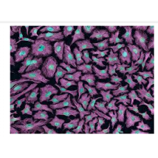 Hela Cell Line