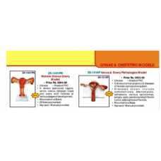 Uterus Ovary Model