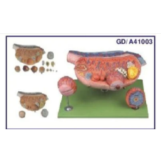 Ovary Model