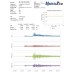 Advanced Seismic Acquisition System - Metric Pro