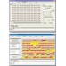 Fully Automated Omnilog PM-M System