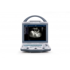 KX5600 Full digital B/W ultrasound scanner Gynecology Obstetics 