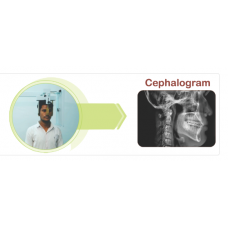 CEPHALOGRAM MODE