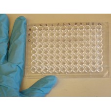 Anti CCP Elisa Kit